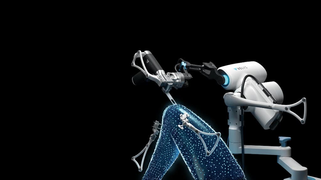 Benefits of Robotic Joint Replacement Surgery
